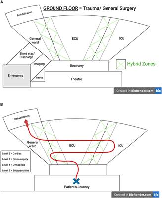 The progressive model of perioperative care